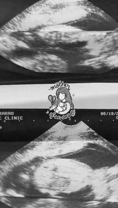 Miscarriage → Health Pregnancy - Before