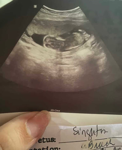 Miscarriage → Health Pregnancy - After