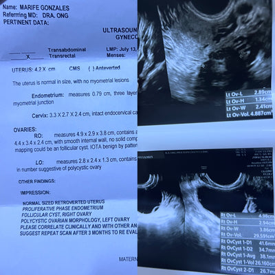 Irregular Cycles → Regular Cycles - Before