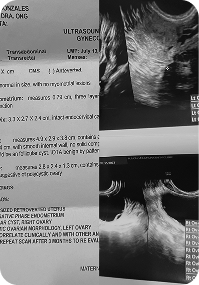 Irregular Cycles → Regular Cycles - Before