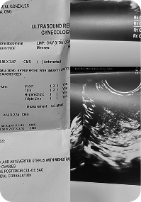 Irregular Cycles → Regular Cycles - After