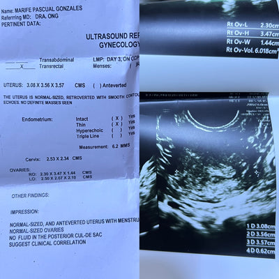 Irregular Cycles → Regular Cycles - After