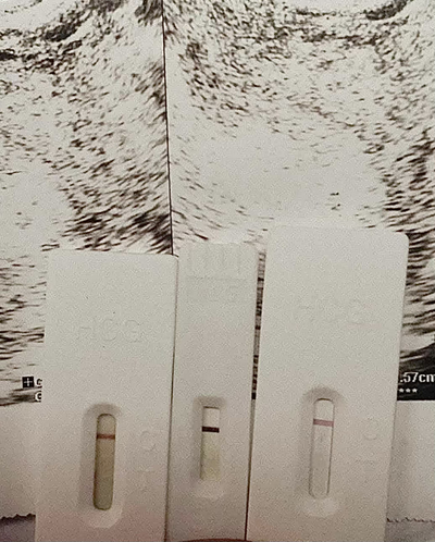 Pregnancy Challenge → Pregnancy success - Before